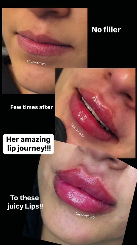 Post 6 by Laynibeauty on TikTok (video)