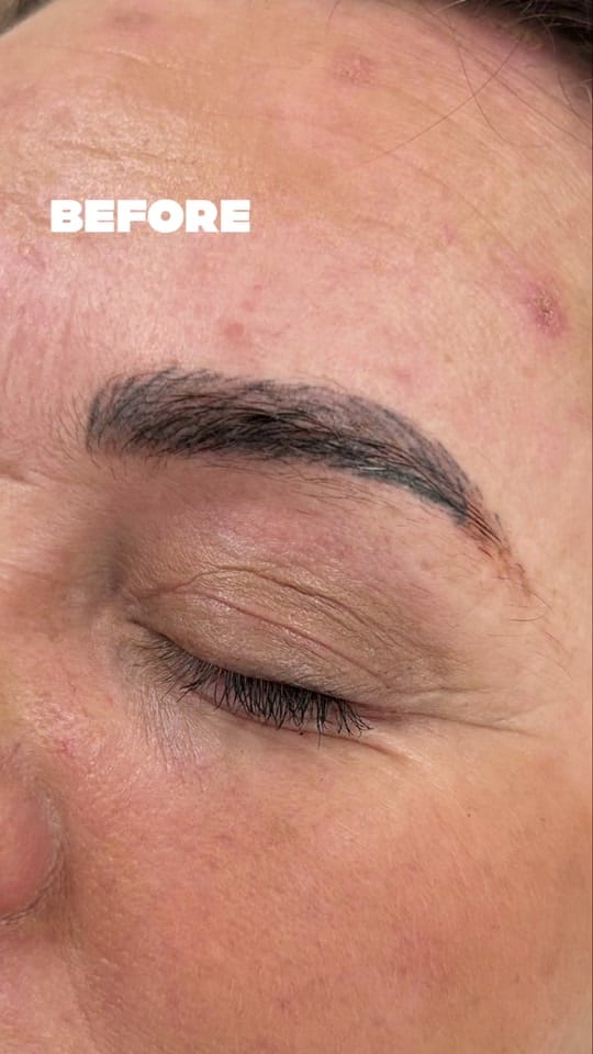 Post 3 by Cardiff Laser Clinic on TikTok (video)