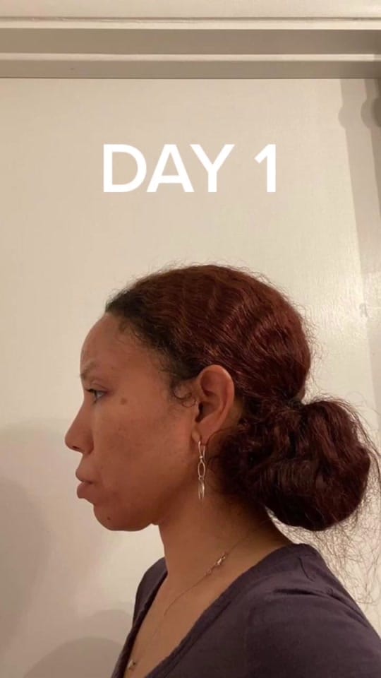 Post 10 by FACEGYM on TikTok (video)