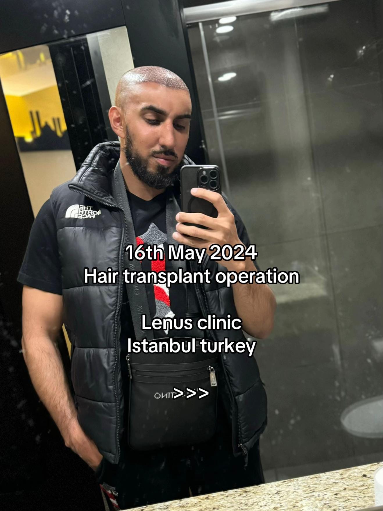 Post 4 by H on TikTok (video)