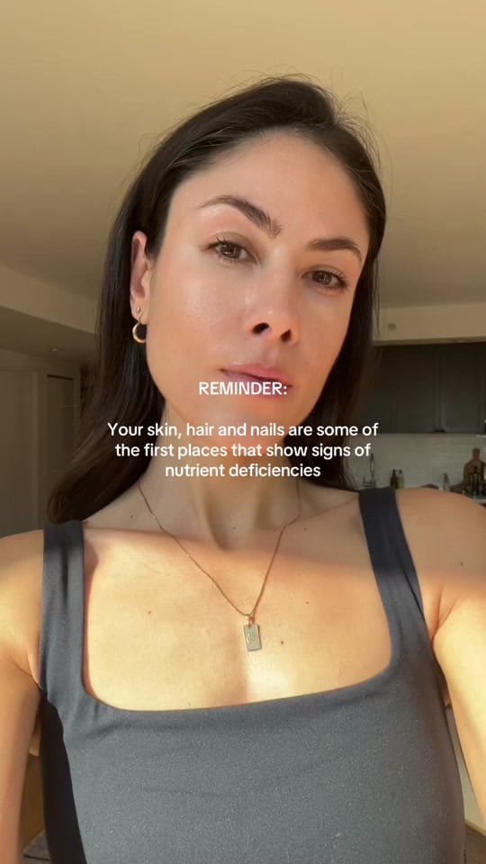 Post 6 by Labrini | Skin + Nutrition on TikTok (video)