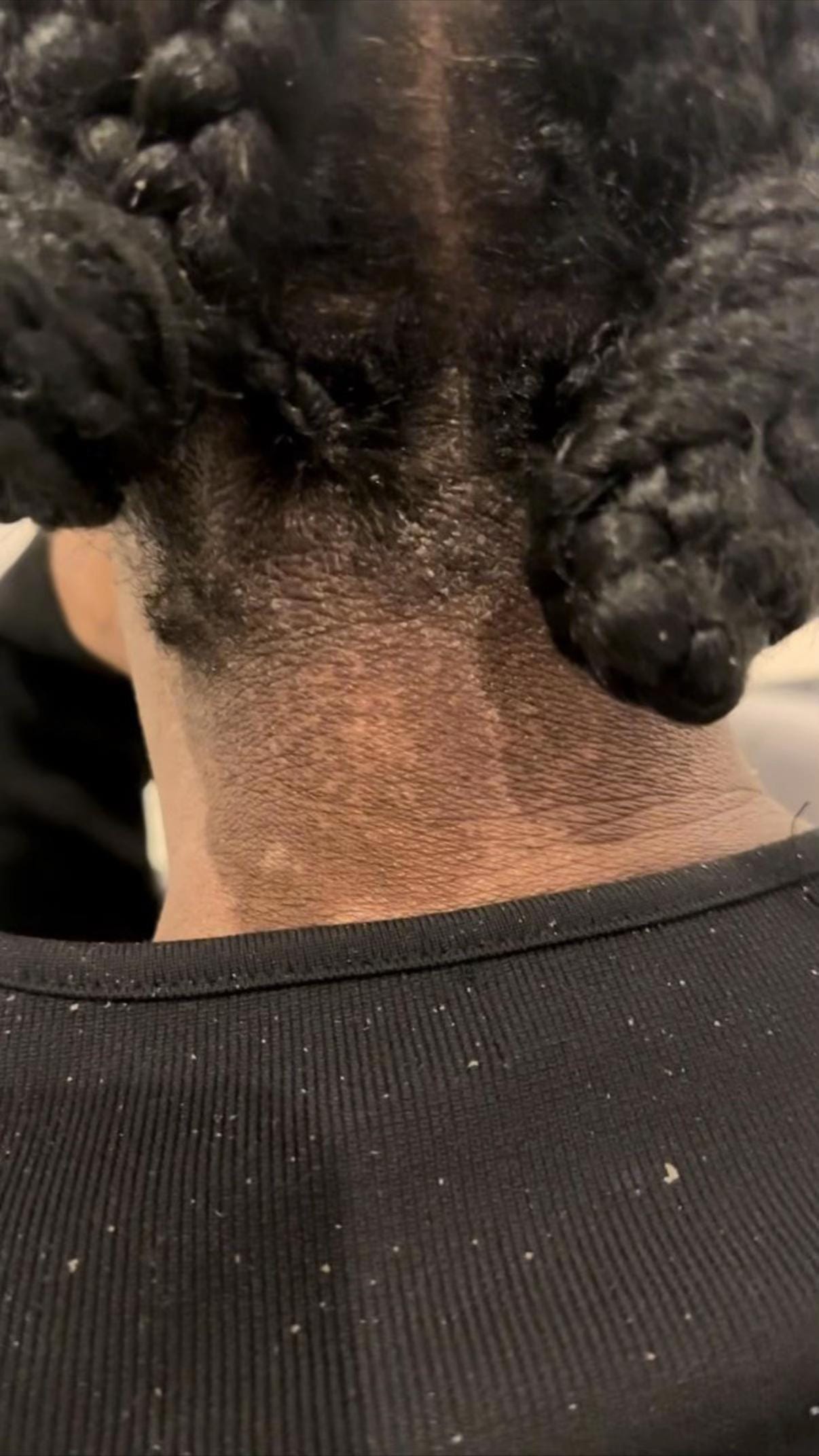 Post 4 by Niecey | FIT | HAIR | ECZEMA & on TikTok (video)