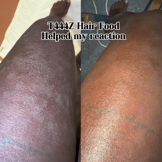 Post 3 by Niecey | FIT | HAIR | ECZEMA & on TikTok (video)