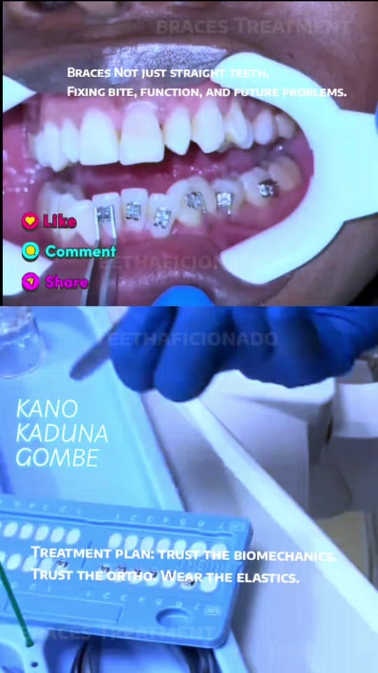 Post 1 by TeethAficionado on TikTok (video)