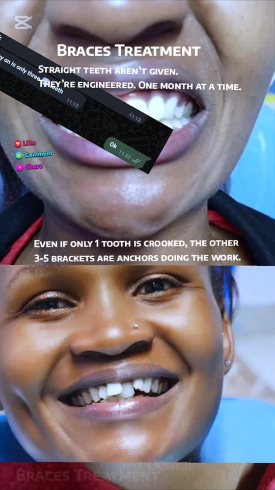 Post 3 by TeethAficionado on TikTok (video)