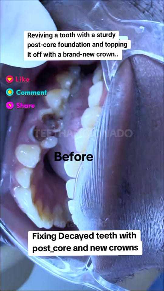 Post 9 by TeethAficionado on TikTok (video)