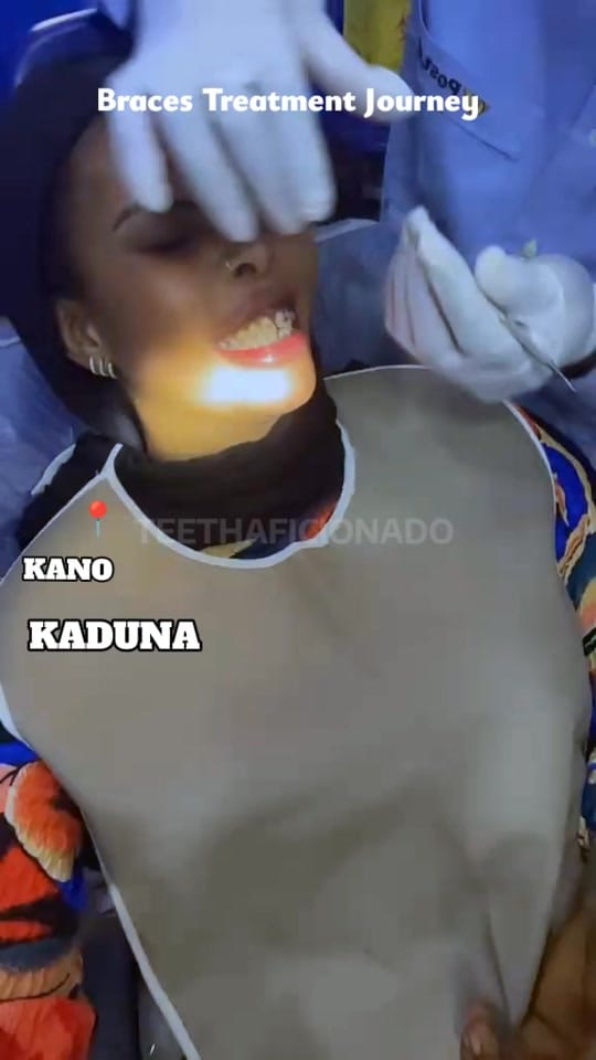 Post 6 by TeethAficionado on TikTok (video)