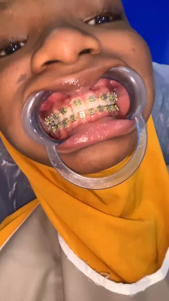 Post 5 by TeethAficionado on TikTok (video)