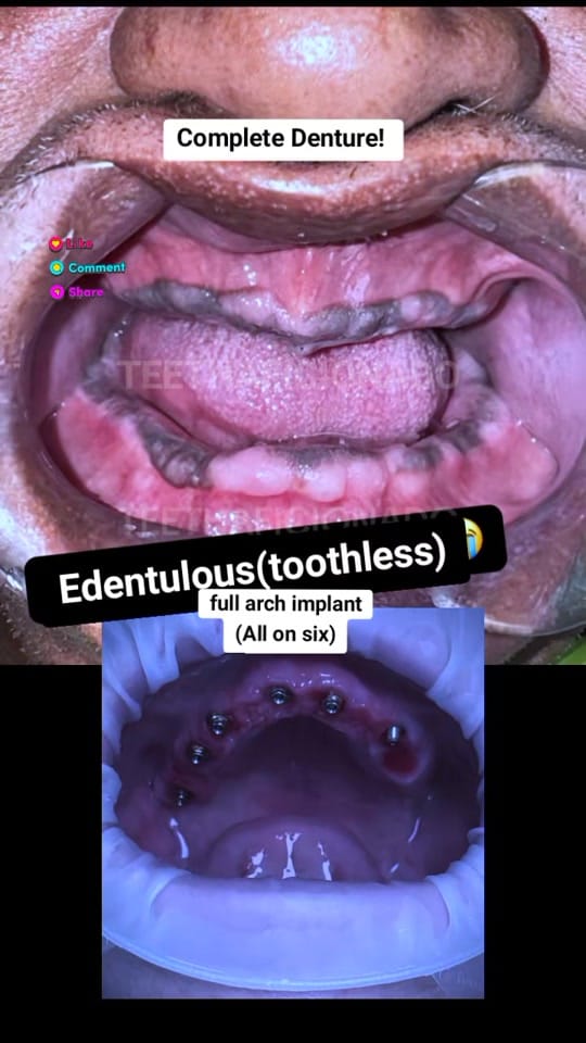 Post 10 by TeethAficionado on TikTok (video)
