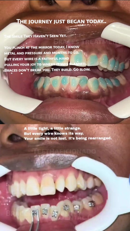 Post 2 by TeethAficionado on TikTok (video)