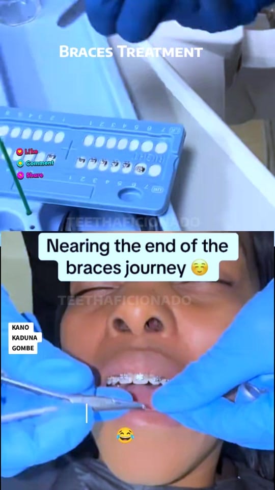 Post 4 by TeethAficionado on TikTok (video)