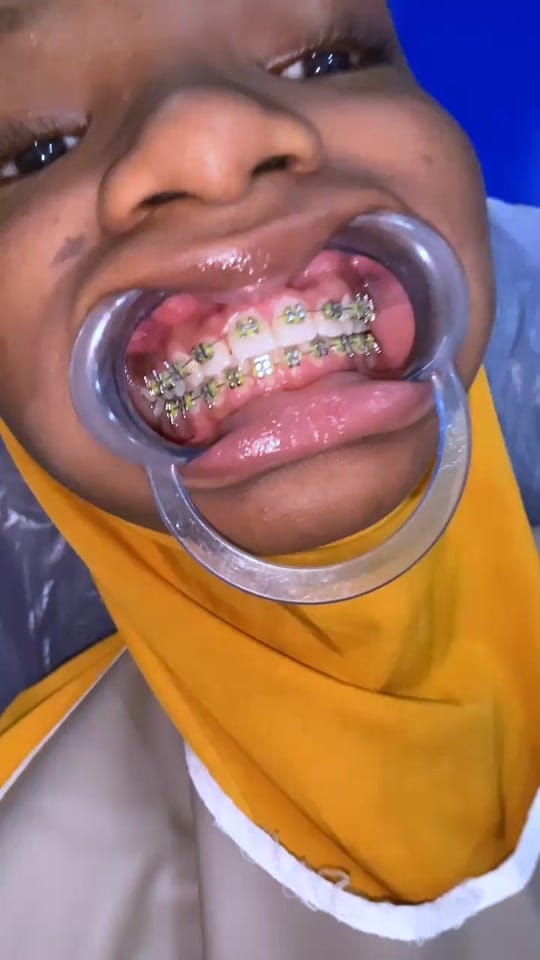 Post 7 by TeethAficionado on TikTok (video)