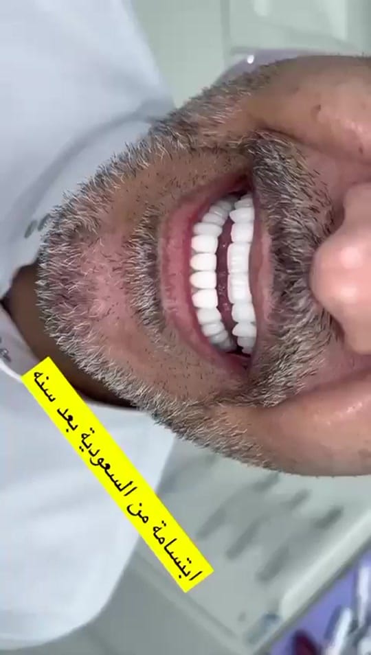 Post 5 by Drrachaghazal on TikTok (video)