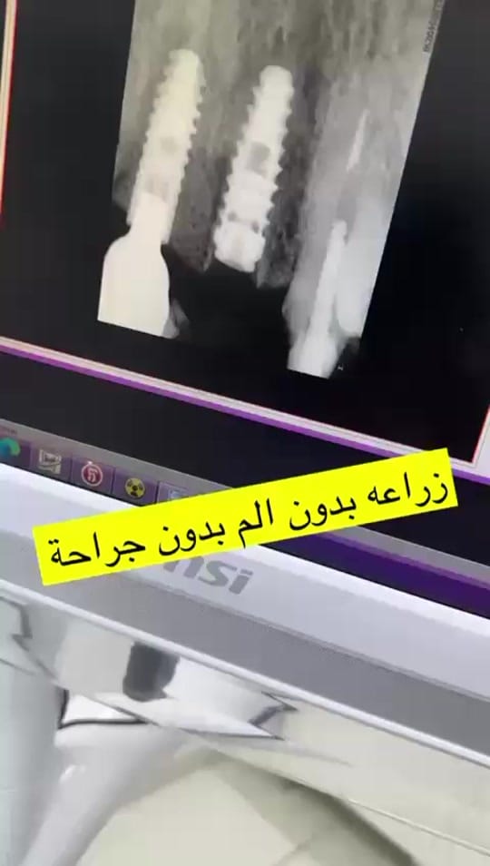 Post 9 by Drrachaghazal on TikTok (video)