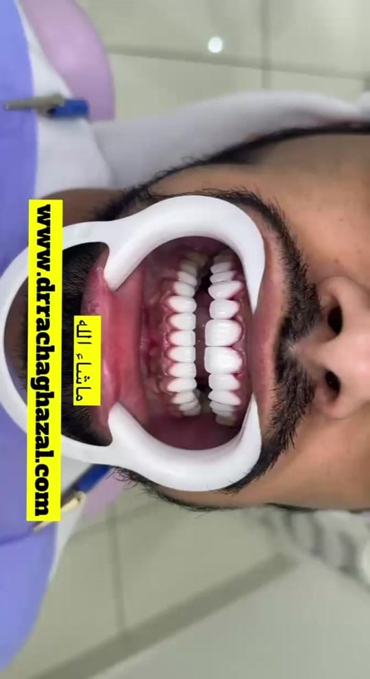 Post 6 by Drrachaghazal on TikTok (video)