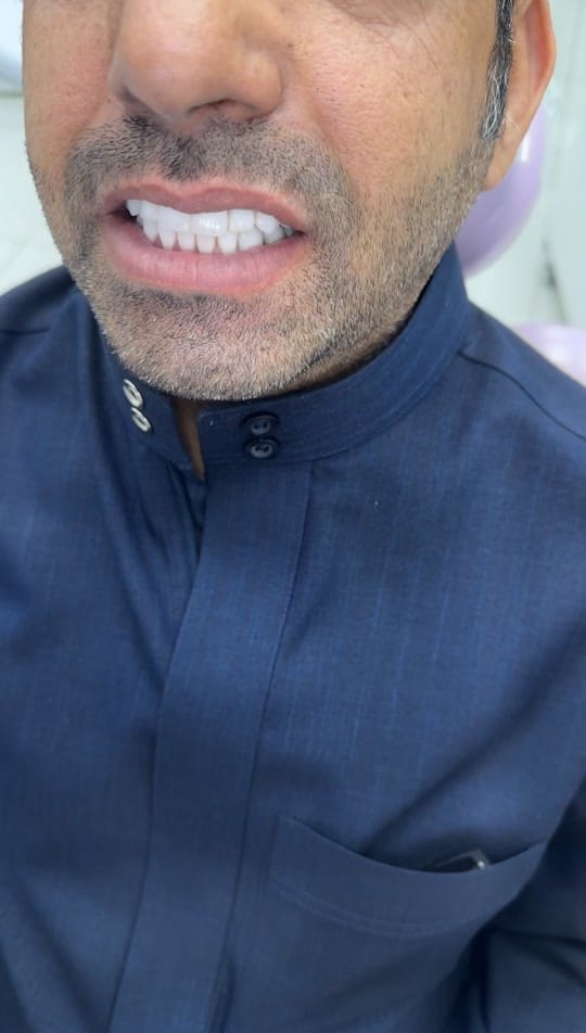 Post 4 by Drrachaghazal on TikTok (video)