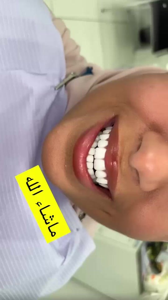 Post 3 by Drrachaghazal on TikTok (video)