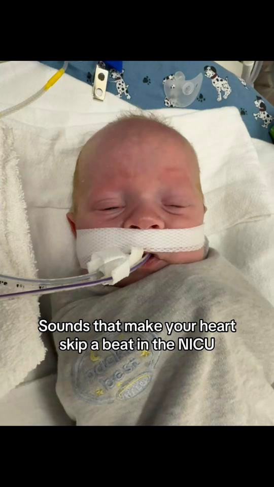 Post 7 by Chelsea | NICU mama 🩵 on TikTok (video)