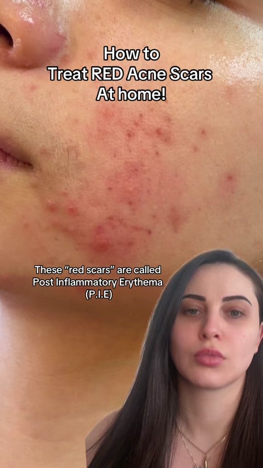 Post 9 by Em on TikTok (video)