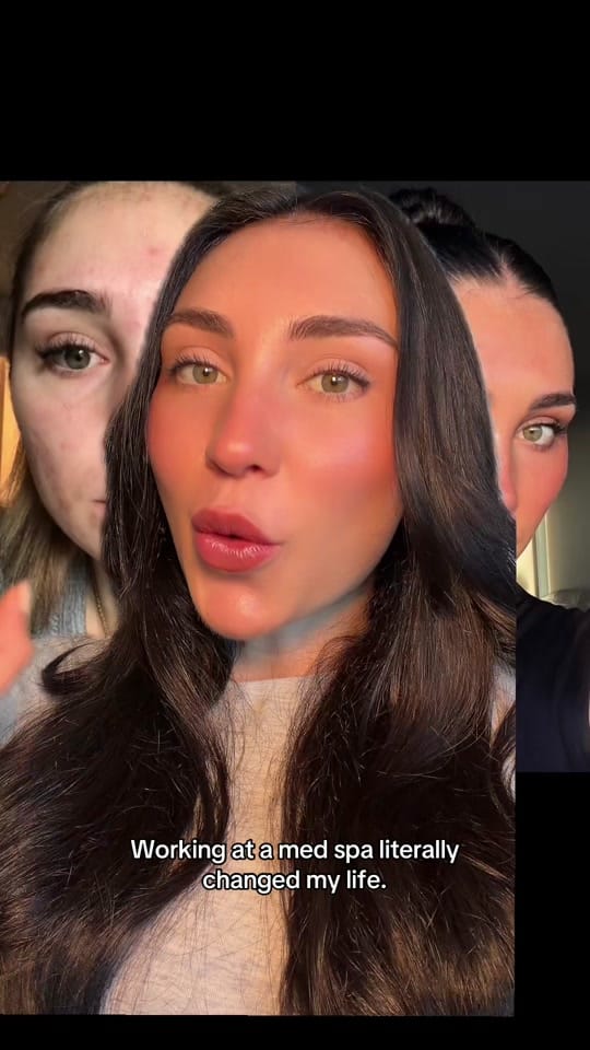 Post 10 by Kaley Patton | NYC Injector on TikTok (video)
