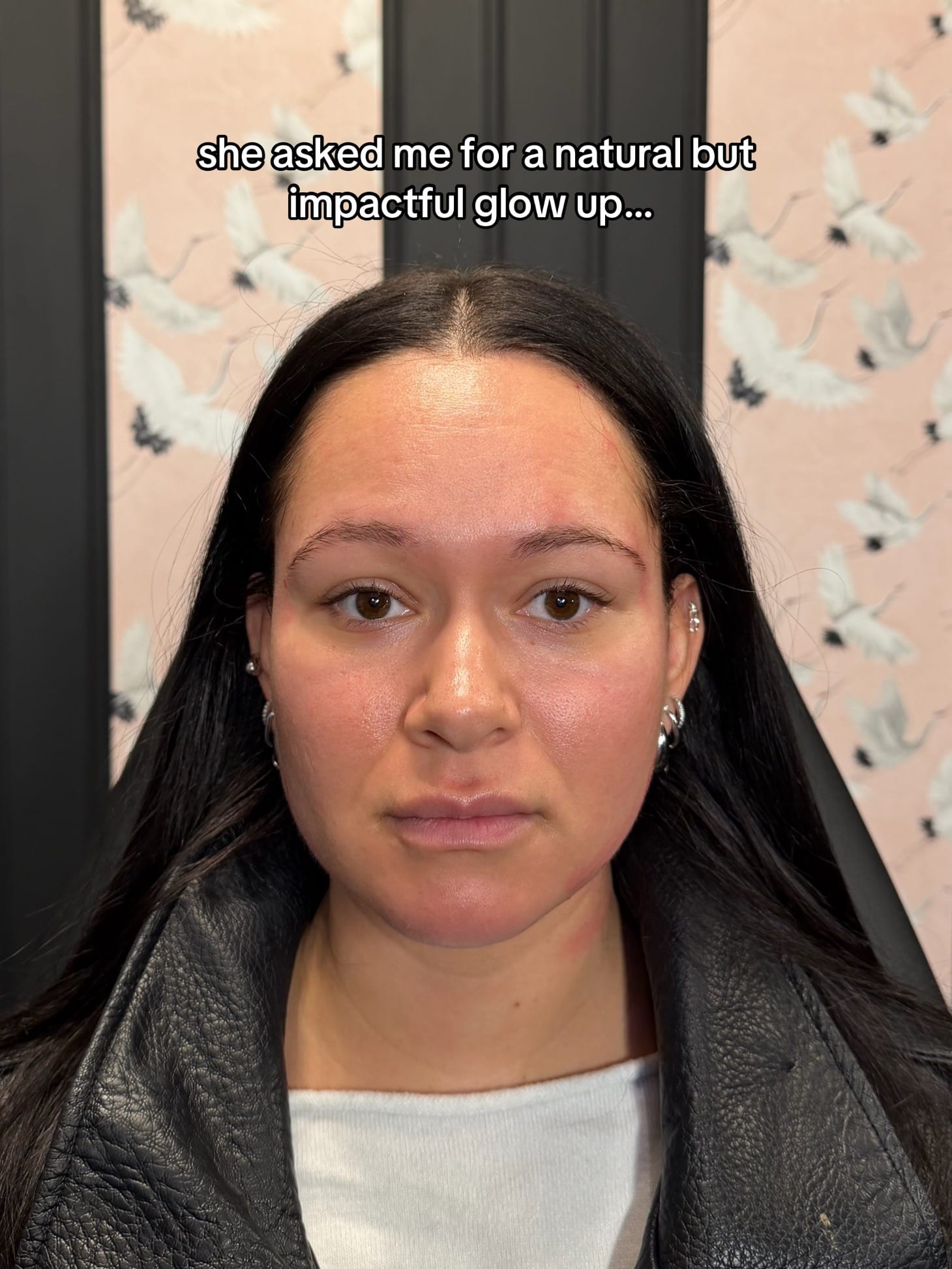 Post 6 by Kaley Patton | NYC Injector on TikTok (video)