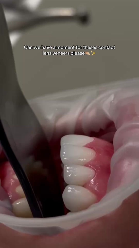 Post 2 by chelseadentalclinic on TikTok (video)