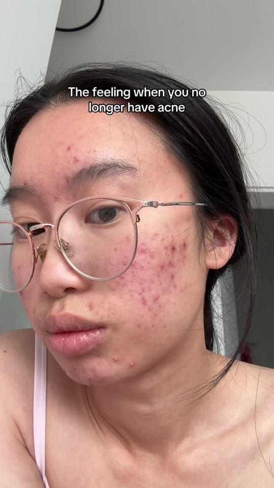 Post 10 by hanawins on TikTok (video)