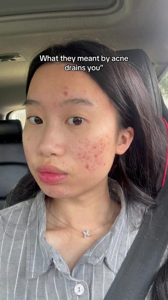 Post 8 by hanawins on TikTok (video)