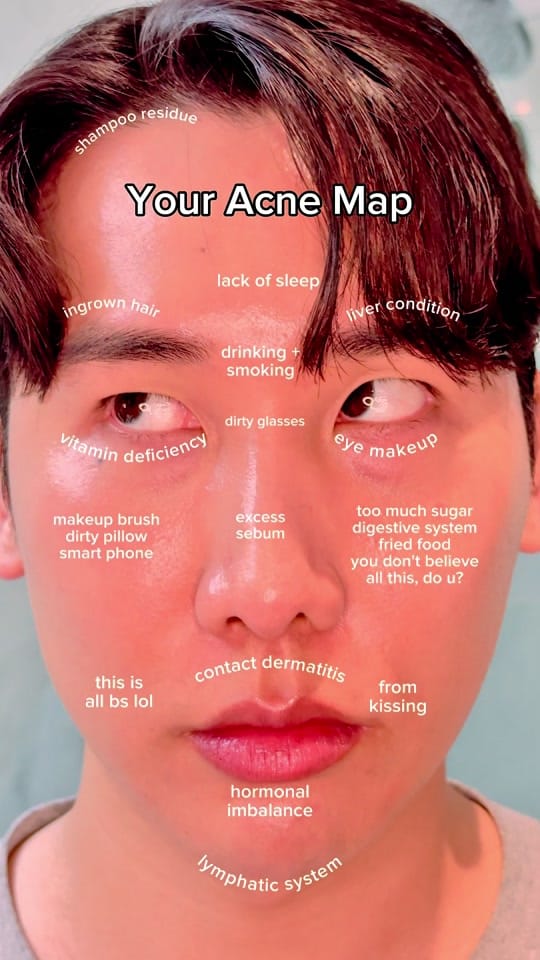 Post 5 by juston on TikTok (video)