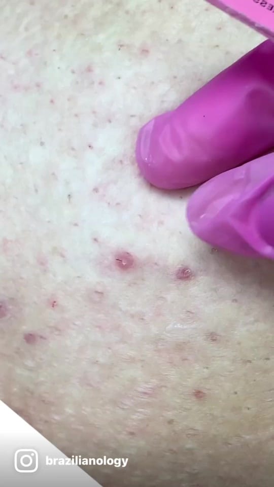 Post 7 by Brazilianology on TikTok (video)