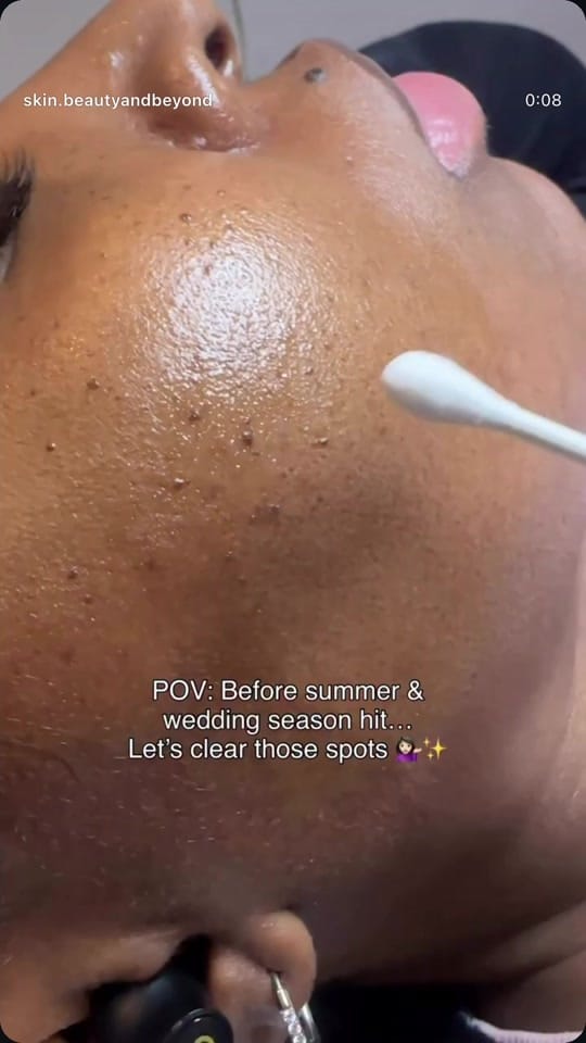 Post 8 by Skin Beauty And Beyond on TikTok (video)