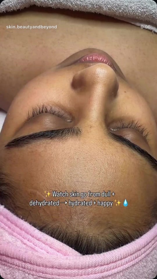 Post 6 by Skin Beauty And Beyond on TikTok (video)