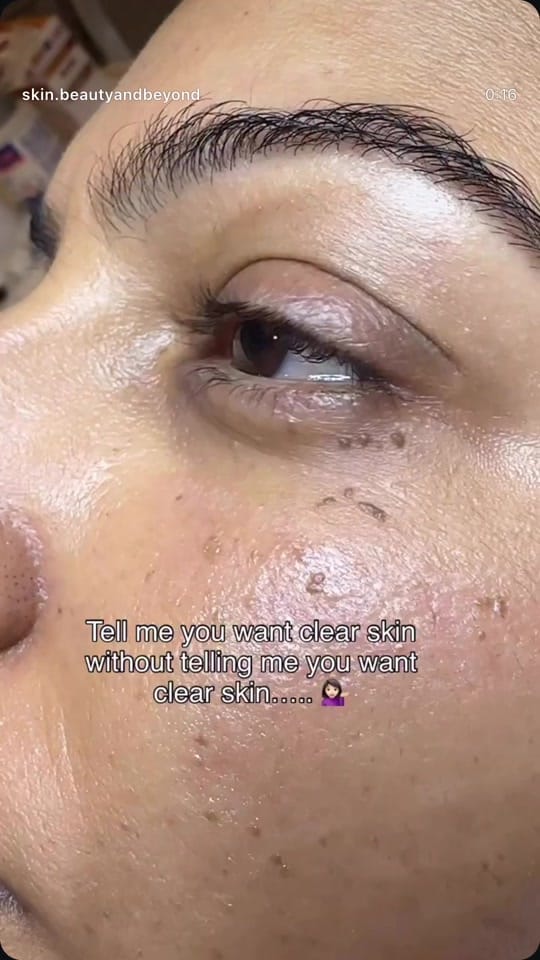 Post 5 by Skin Beauty And Beyond on TikTok (video)