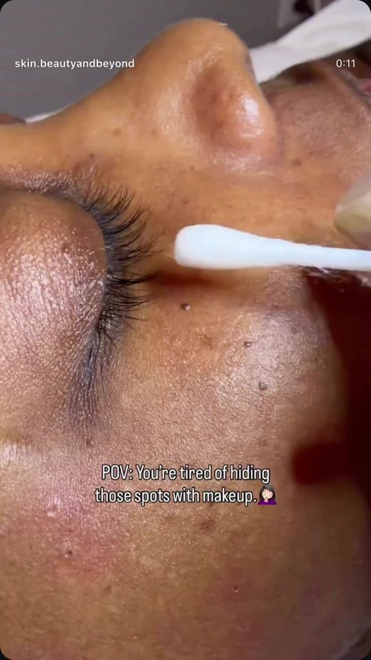 Post 4 by Skin Beauty And Beyond on TikTok (video)
