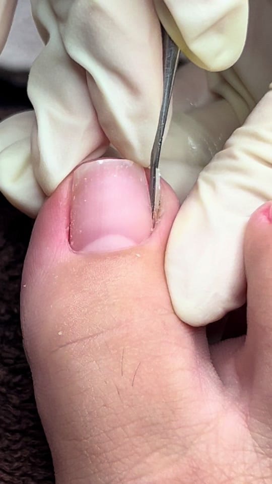 Post 9 by PrecisionPedicare05 on TikTok (video)