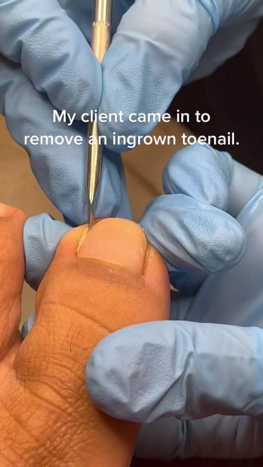 Post 10 by PrecisionPedicare05 on TikTok (video)
