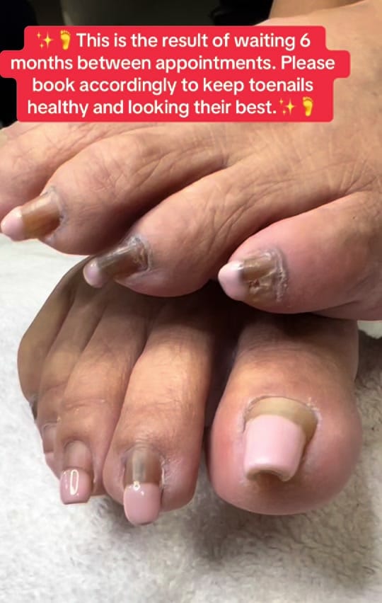 Post 5 by PrecisionPedicare05 on TikTok (video)