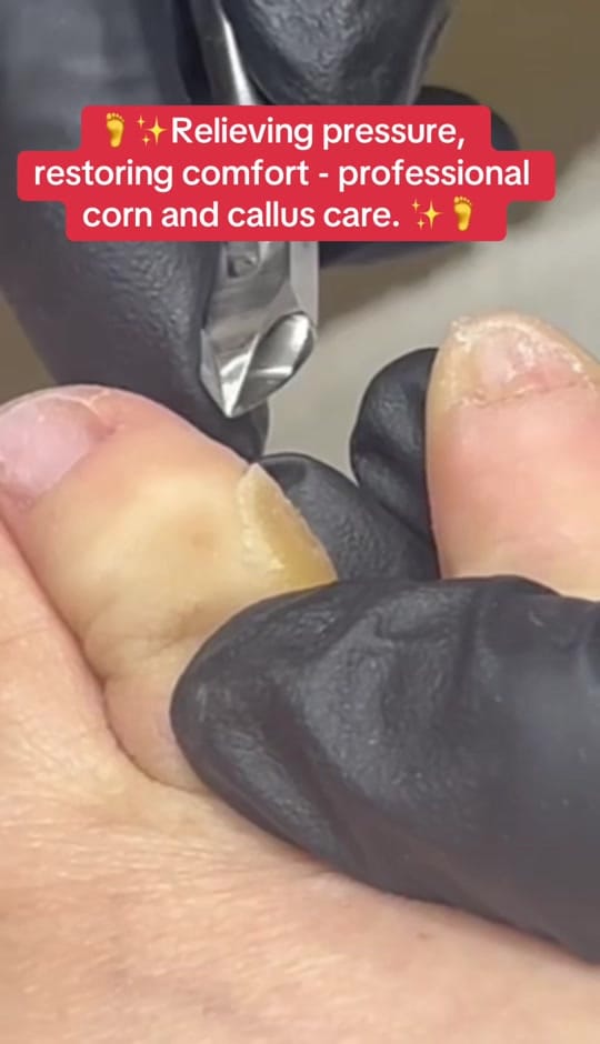Post 3 by PrecisionPedicare05 on TikTok (video)