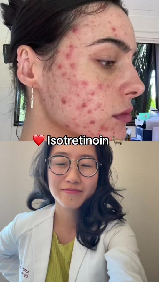 Post 5 by dermdoc.annie on TikTok (video)