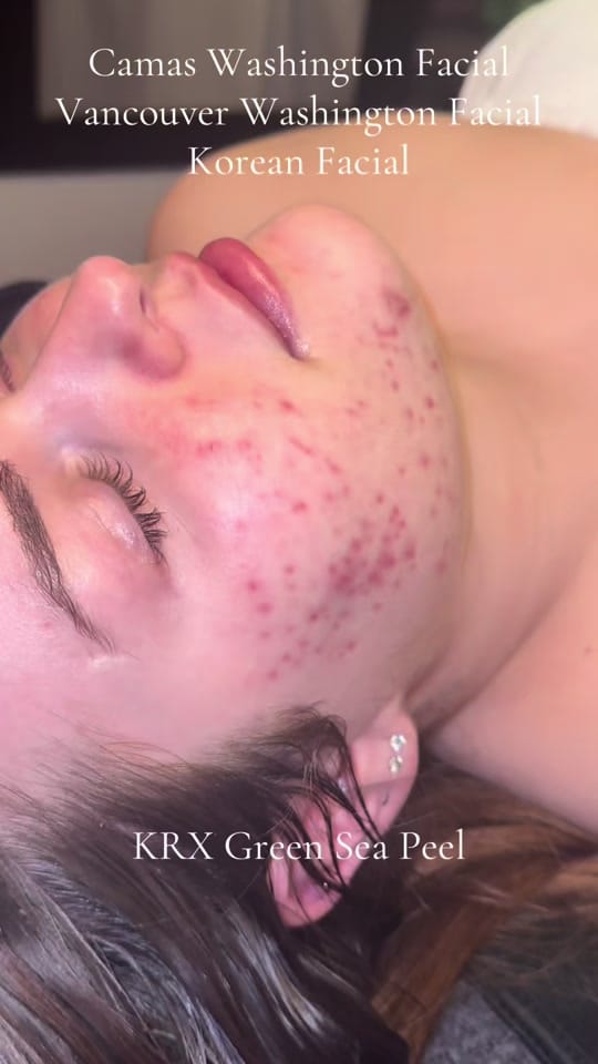 Post 7 by ANGEL | Camas Esthetician 🌿 on TikTok (video)