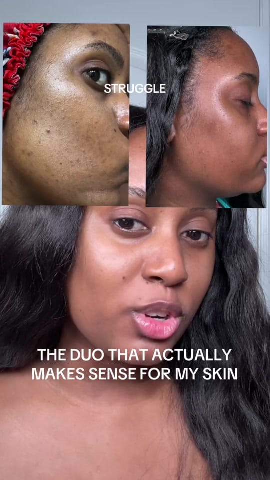 Post 7 by donna | skin health + beauty on TikTok (video)
