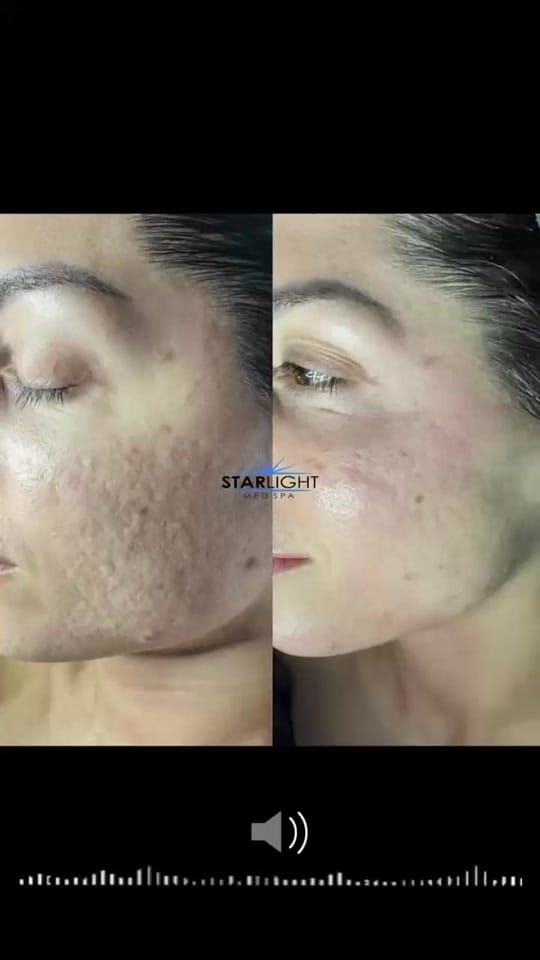 Post 1 by Starlight Med Spa on TikTok (video)