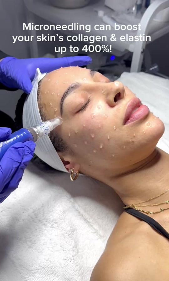 Post 10 by Starlight Med Spa on TikTok (video)