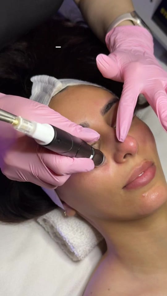 Post 5 by TS Medspa on TikTok (video)