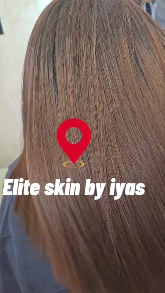 Post 4 by 💫Elite Skin by Iyas 💫 on TikTok (video)