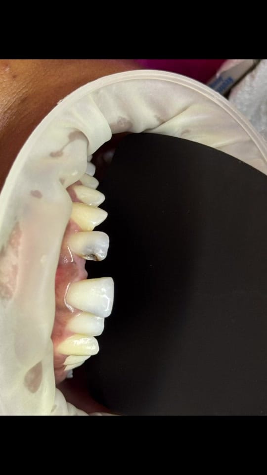 Post 3 by Grace Dental Suite on TikTok (video)