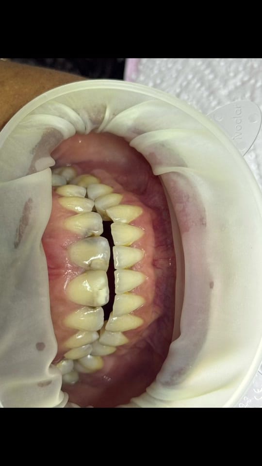 Post 7 by Grace Dental Suite on TikTok (video)