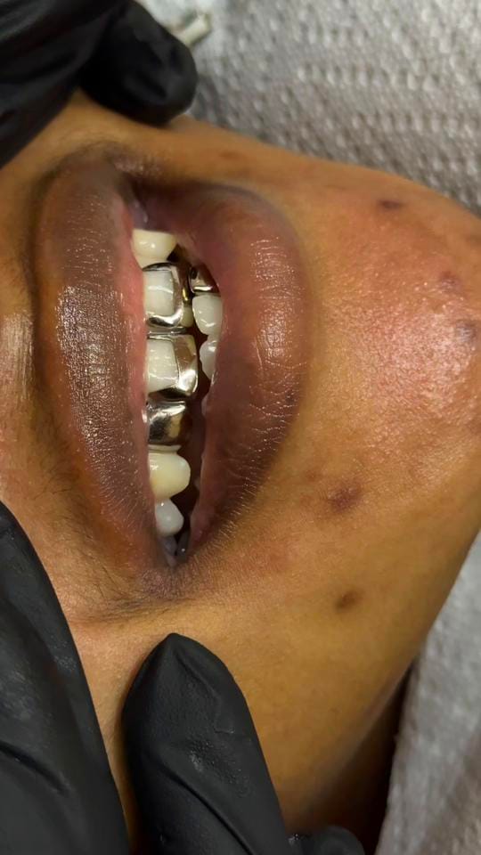 Post 1 by Grace Dental Suite on TikTok (video)