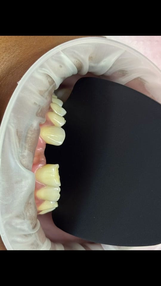 Post 4 by Grace Dental Suite on TikTok (video)
