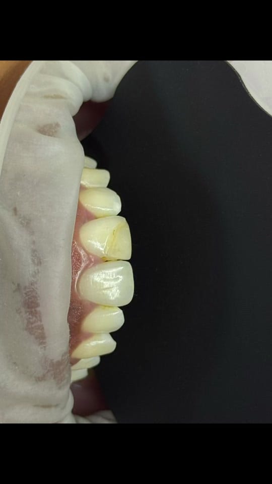 Post 8 by Grace Dental Suite on TikTok (video)